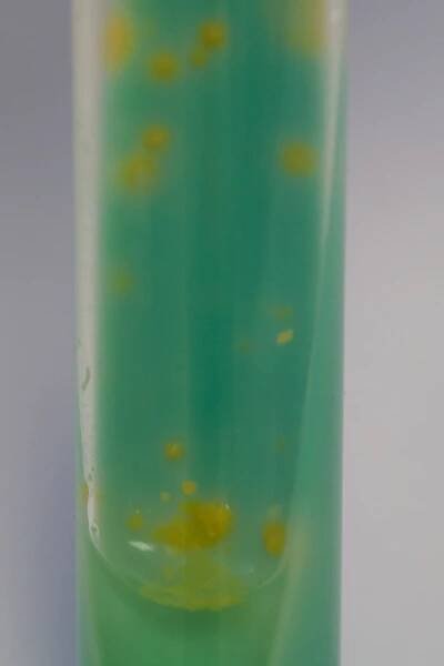 Mycobacterium kansasii