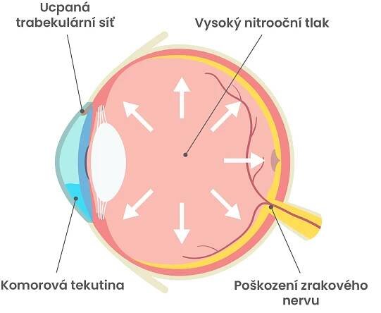 Poruchy vidění - Kurzy Aeroweb.cz
