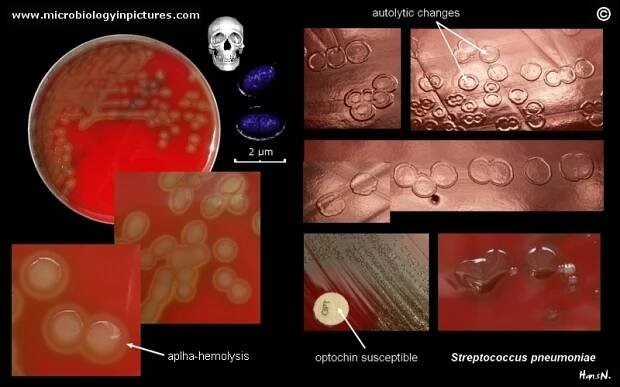 Streptococcus pneumoniae bacteria