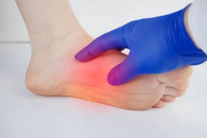ortopedický lékař zkoumá ženskou nohu. bolest paty, protahování šlach, zánět, patní ostruha. koncepce léčby onemocnění nohou - patní ostruha - stock snímky, obrázky a fotky