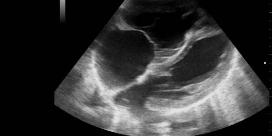 7. týden těhotenství (7. TT): Těhotenské změny a vývoj plodu