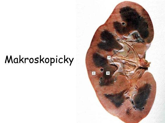 PPT - Fyziologie ledvin Část 2. PowerPoint Presentation, free download - ID:540851