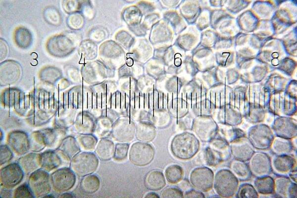 Pekařské kvasinky (Saccharomyces cerevisiae) | iROZHLAS - spolehlivé zprávy