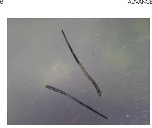 (PDF) Advanced Endodontics
