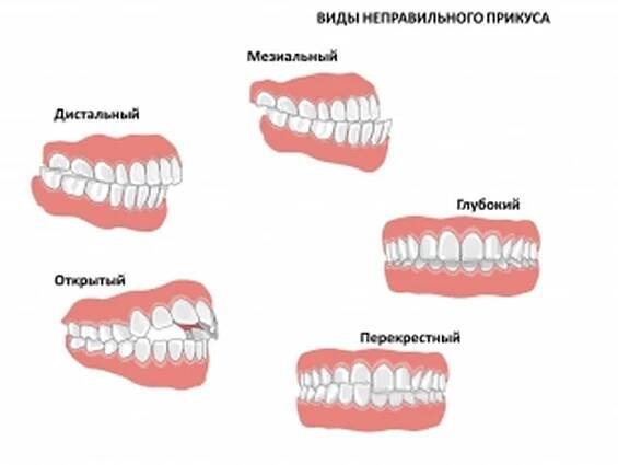 Jak zubní péče ovlivňuje srdeční onemocnění? / Články | Užitečné informace a tipy na péči o sebe. Zdraví, výživa a další