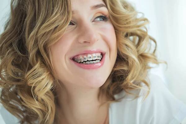Oral Hygiene With Braces