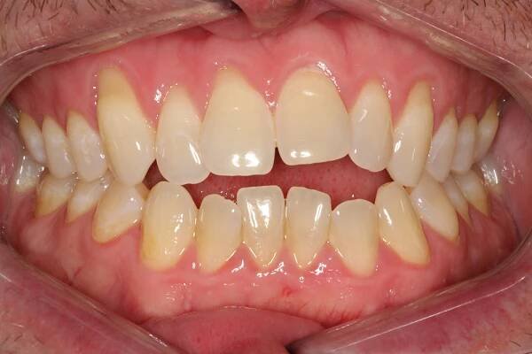 Before and After • 425 Dental