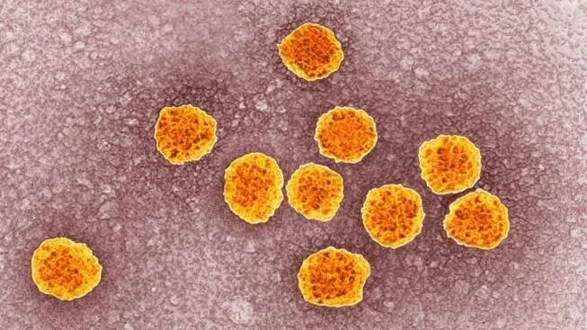 Lékaři představili novou léčbu žloutenky C, zabírá téměř stoprocentně