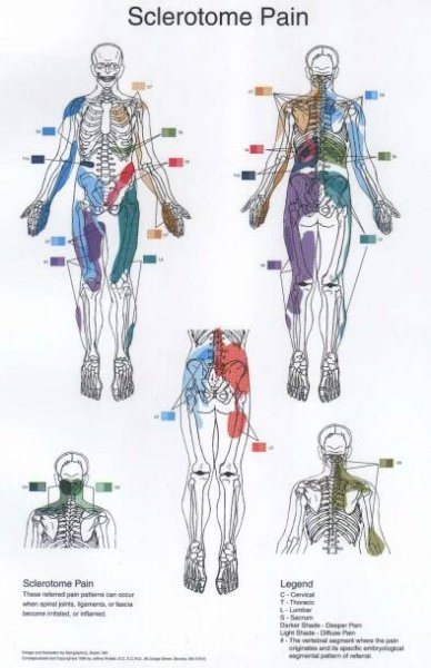 VISCEROSOMATIC - TRIGGER POINTS - VASCULATURE