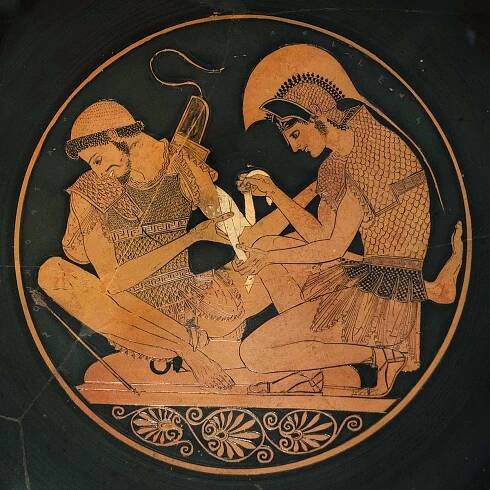 Achilles bandages Patroklos’ arm. Berlin, State Museums, Old Museum (Staatliche Museen zu Berlin, Altes Museum)