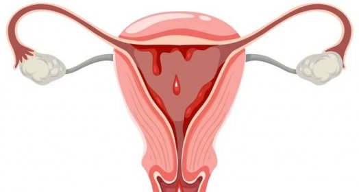 Přebytek estrogenu způsobuje nepříjemné následky. Patří mezi ně i únava a bolestivá menstruace