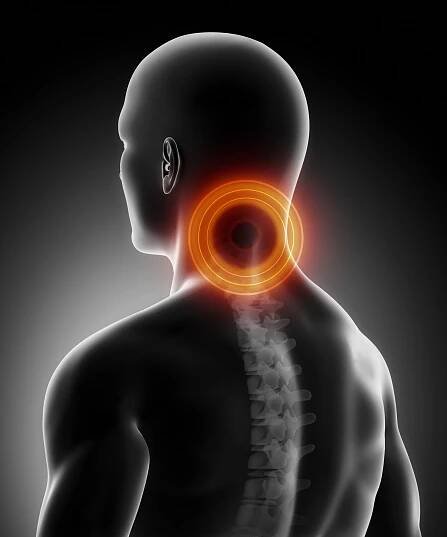 Bolest krční páteře anatomie — Stock obrázek