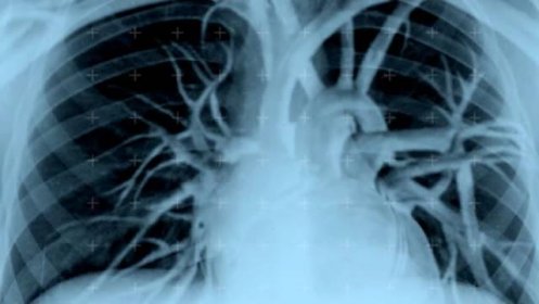 Živý rentgenový snímek lidského trupu