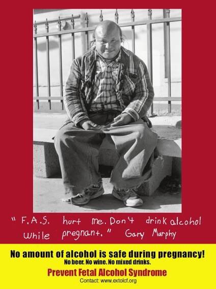 Gary Murphy poster
